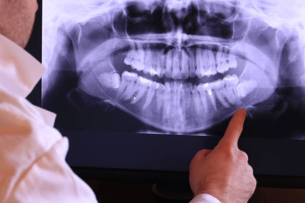 Best Pediatric Emergency Dentist in East Bangor, PA