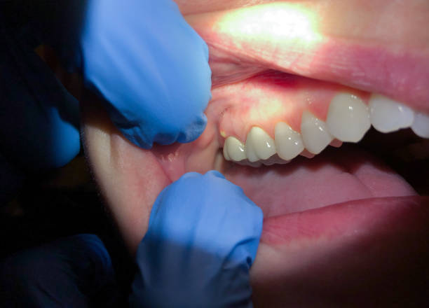 Best Pediatric Emergency Dentist in East Bangor, PA