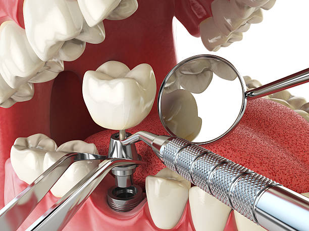 Best Emergency Dental Services for Seniors in East Bangor, PA